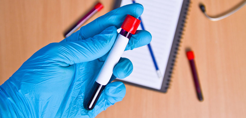 How to Become Phlebotomist