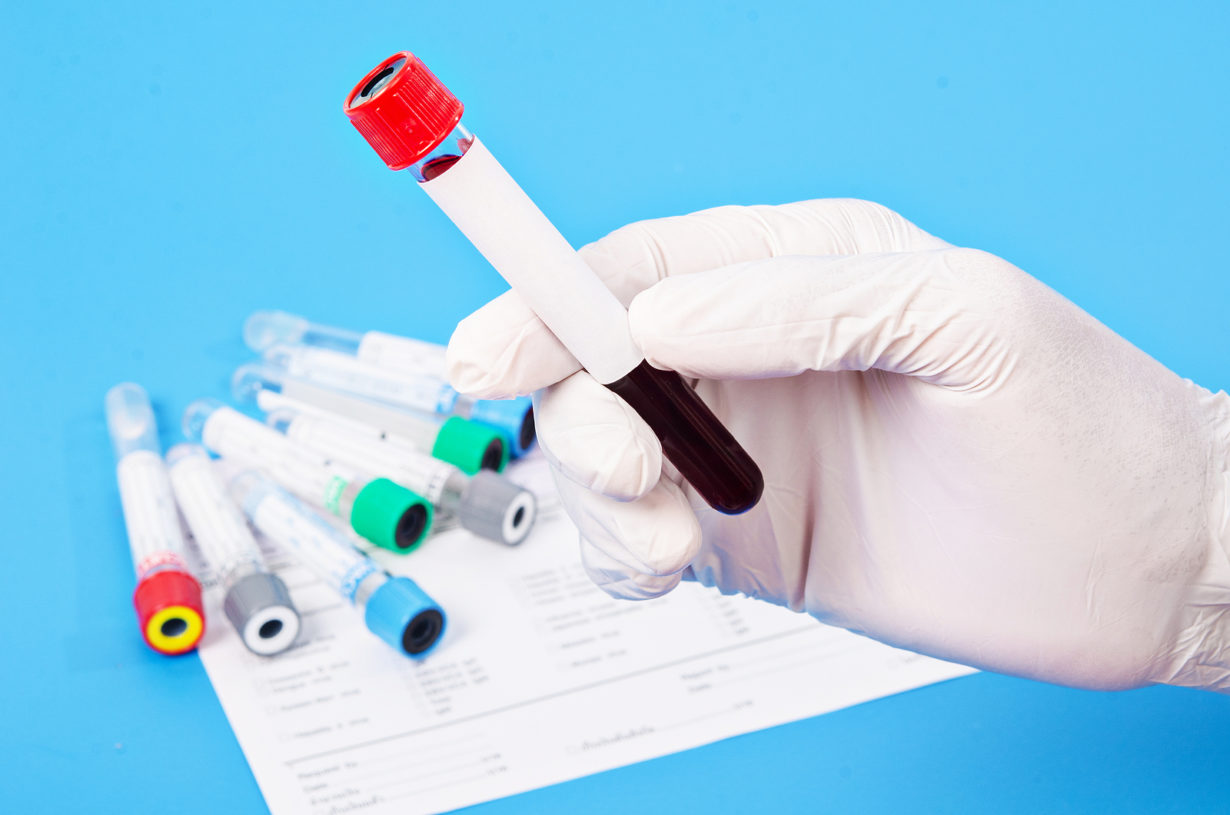 Phlebotomy Classes in Fresno, CA
