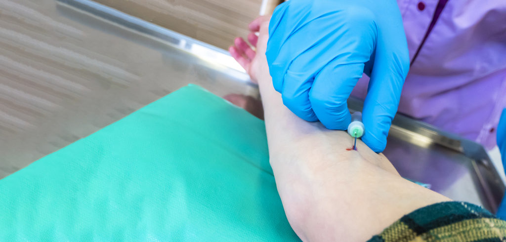 nurse about to begin drawing blood from right arm of patient.